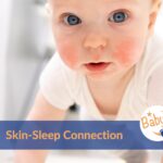 Sleep-skin connection
